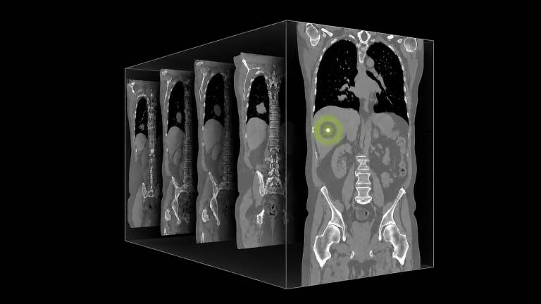 NVIDIA releases NV-Reason-CT for 3D CT analysis with chain-of-thought reasoning